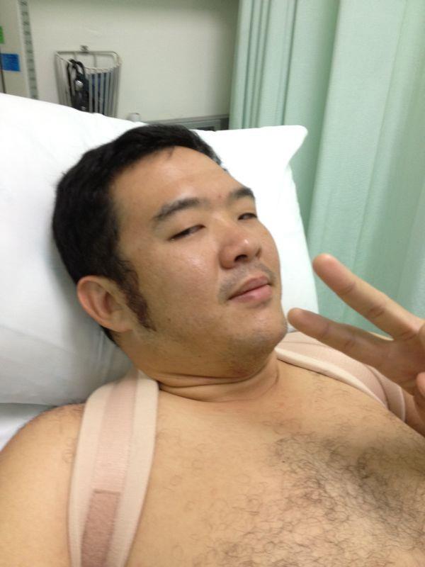 ขนเยอะเกิ๊น!!