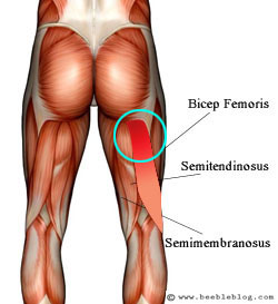 Groin_Injury01.jpg